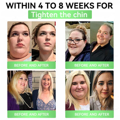 🔥Official Store| 🧑‍⚕️Alcuras™ Moringa × Berberine × AMPK 8-Benefit Slimming & Metabolic Nano Microneedle Patch 🇺🇸  Just once a day · Visible changes in 7 days  ✅ For obesity, loose skin, diabetes, sleep apnea, joint issues, and more🔥